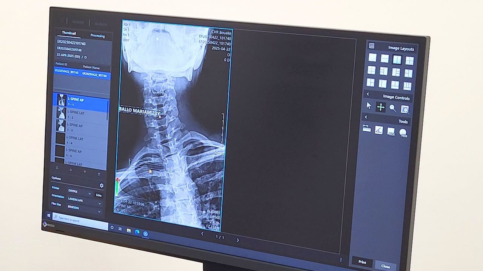 Santé de proximité : Le service d’imagerie médicale du CHR de Bouaké au cœur de l’offre de soins