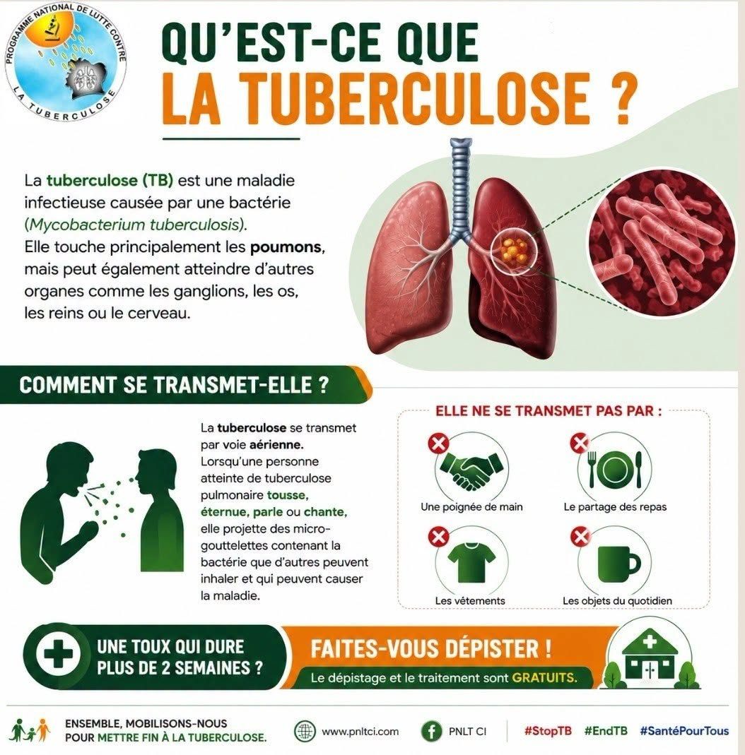 Tuberculose : La Côte d’Ivoire passe d’une forte endémie à une endémie modérée